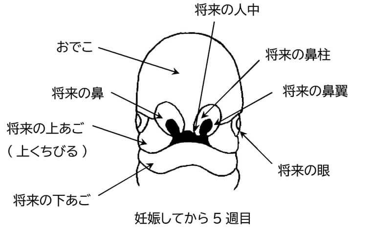 口唇口蓋裂とは 口の変形 生まれつきの病気 形成外科で扱う疾患 一般の方へ 一般社団法人 日本形成外科学会
