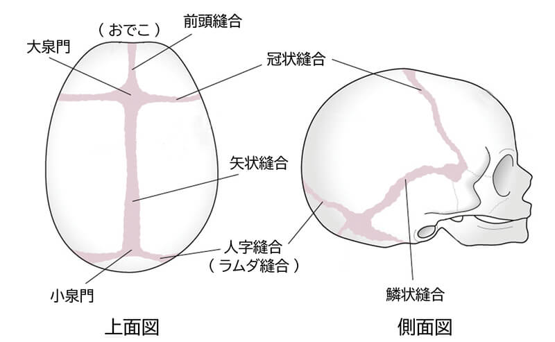 頭蓋縫合早期癒合症 日本形成外科学会