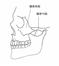 頬骨骨折 顔の骨の骨折 けが きずあと 形成外科で扱う疾患 一般の方へ 一般社団法人 日本形成外科学会