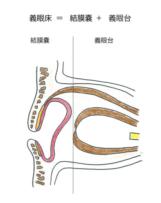 義眼床手術 その他 形成外科で扱う疾患 一般の方へ 一般社団法人 日本形成外科学会